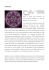NOROVIRUS NORWALK VIRUS - LA TRASMISSIONE DEL