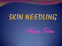 skin needling - ANGELA TERLIZZI