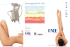 EME srl - Leaflet Epil Evo (Laser a diodo)