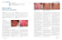 aging vulvare: led e acido ialuronico