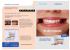 PDF CLEARFIL MAJESTY™ Posterior Brochure