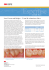 Lava Crowns and Bridges