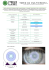 TORIC 04 MULTIVISION L e V