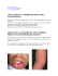 CHI COLPISCE LA SINDROME ORTICARIA