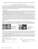 Developmental Venous Anomalies (Venous Angiomas) on