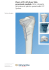 Placca LCP 4.5/5.0 per tibia prossimale mediale. Parte integrante