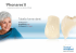 Tabella forme denti - Ivoclar Vivadent AG