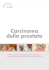 Carcinoma della prostata
