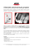 SENSORE INTRAORALE HANDY