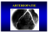 arteriopatie - Fisiokinesiterapia