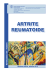 Artrite reumatoide