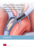 Fate evolvere le procedure Lead Extraction™ con la