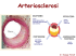 Arteriosclerosi