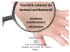 Presentazione di PowerPoint - Ospedale Sacro Cuore Don Calabria