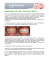 sbiancamento dei denti in una sola seduta