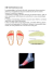 METATARSALGIA