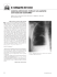 la radiografia del mese