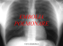 Embolia polmonare