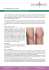 eliminazione capillari vene gambe