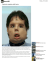Trapianto completo della faccia