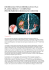 EMORRAGIA INTRACEREBRALE DA VKA: PLASMA FRESCO +