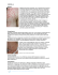 VARICELLA Malattia Malattia fortemente contagiosa, che si