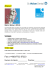 Nuovo! - Dental Matrices of Dr. Walser Dental