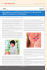 Menopausa e sindrome della bocca che brucia (BMS): le strette