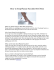 How to Stop Plantar Fasciitis Heel Pain.